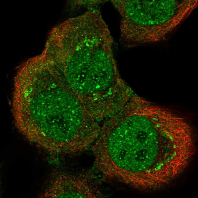 Immunofluorescent staining of human cell line HaCaT shows localization to nucleoplasm, nucleoli fibrillar center & the Golgi apparatus.